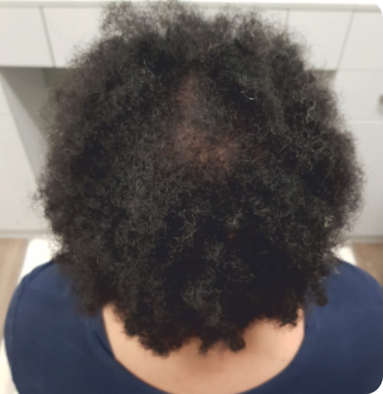 After Image