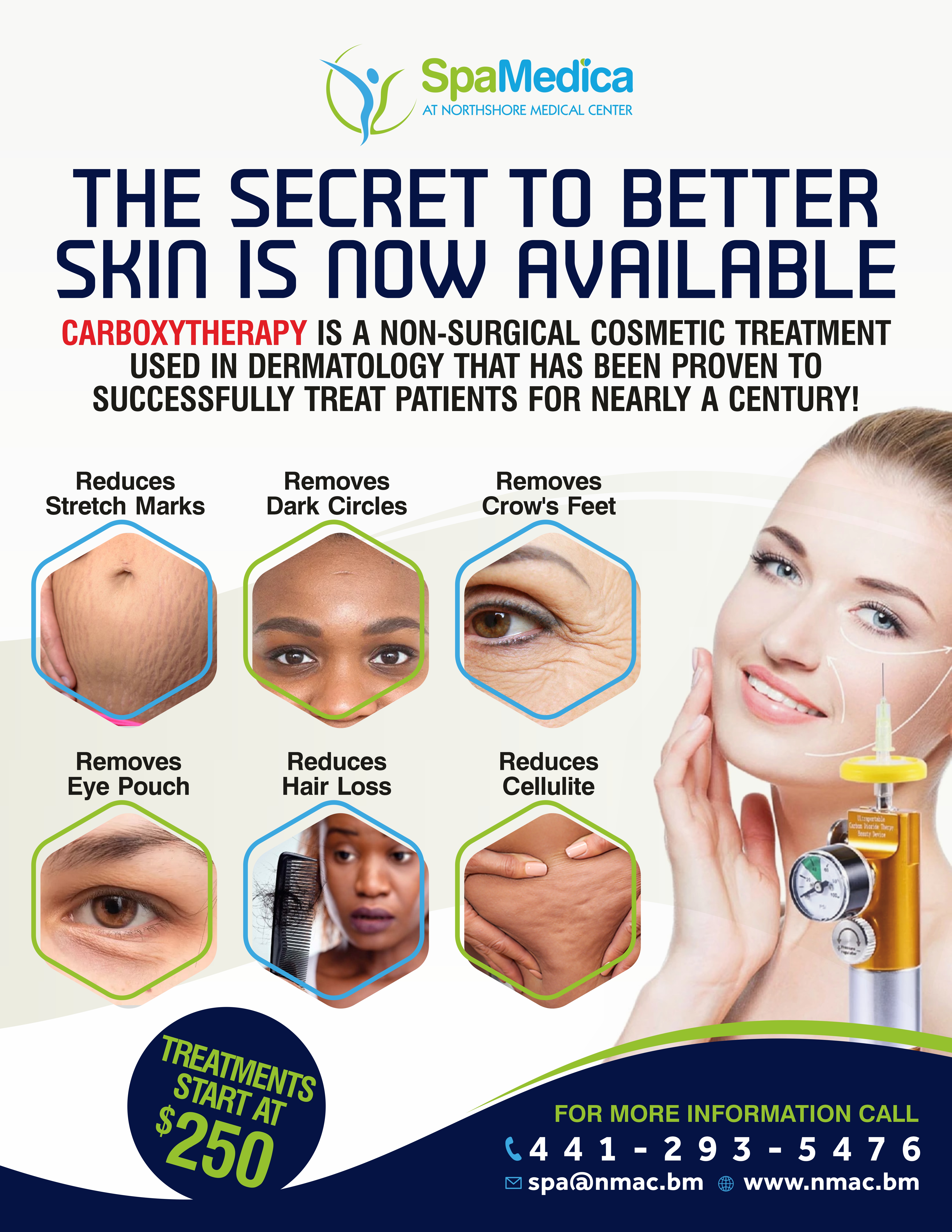 Carboxytherapy