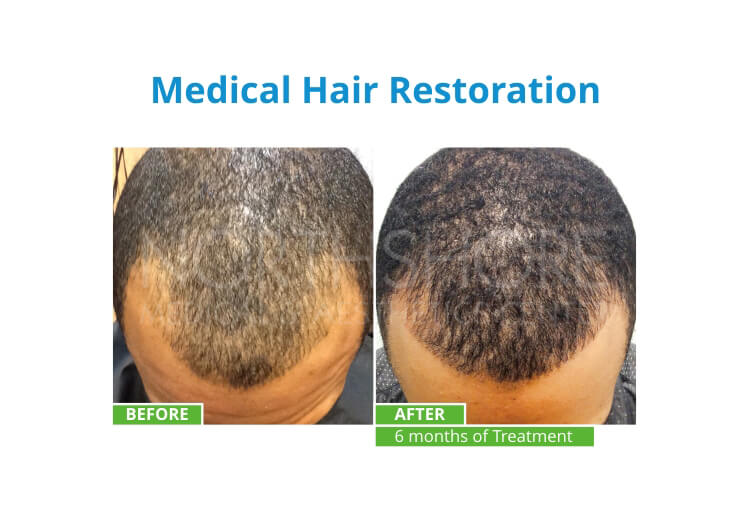 Before & Afters 