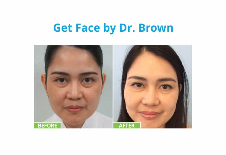 Before & Afters 