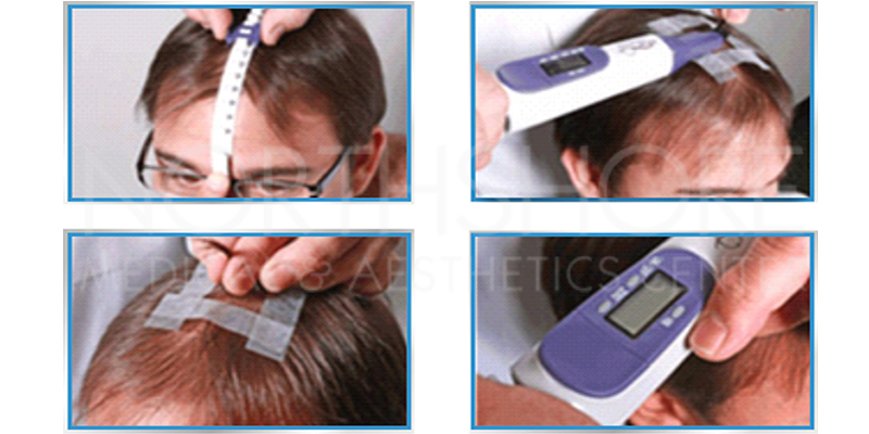Hair measurements Device