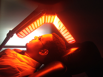 Laser Hair Loss