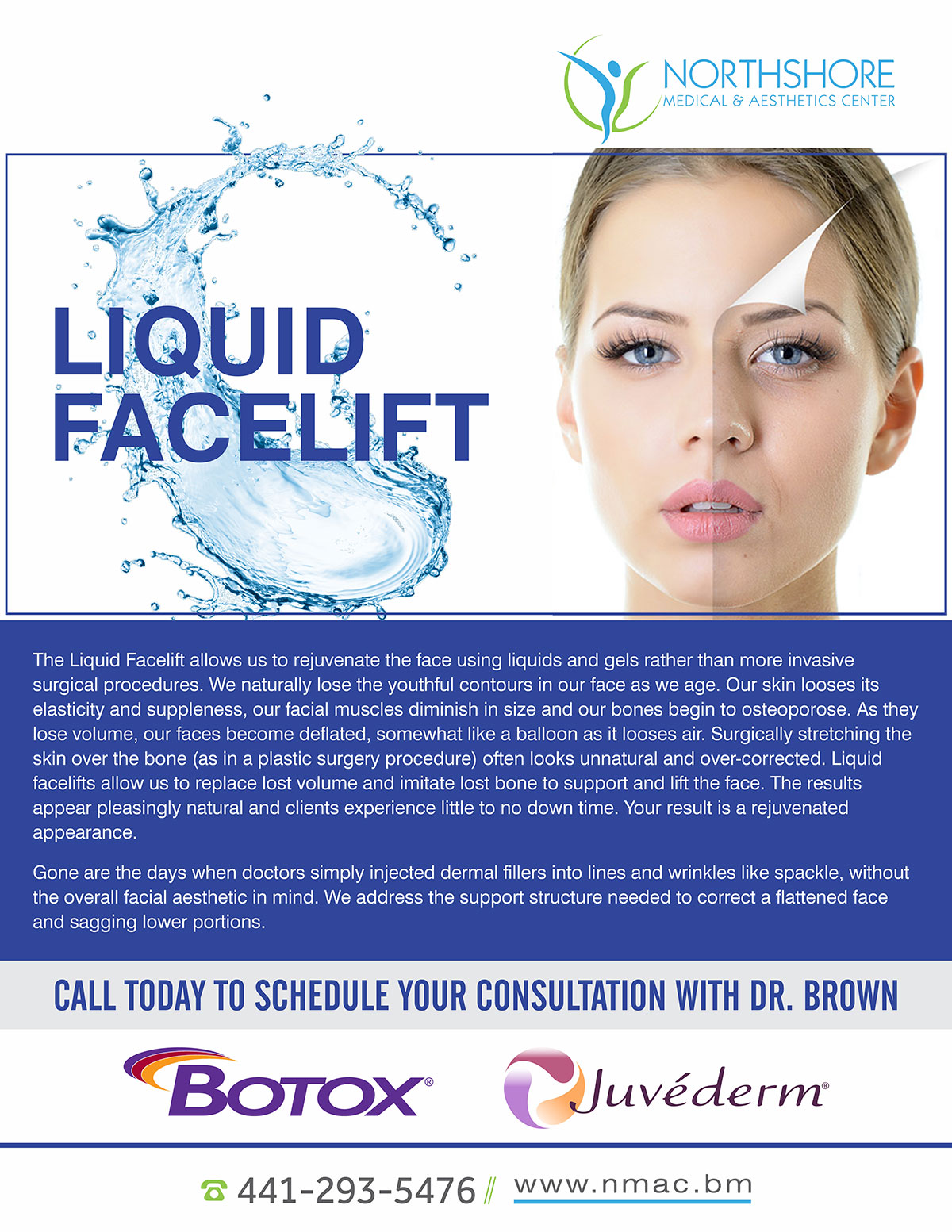 Liquid Face Lift