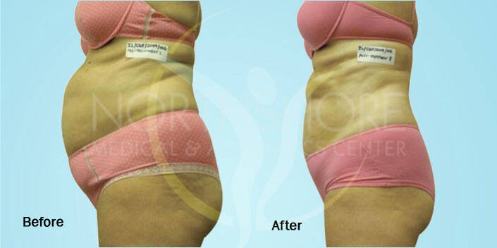Spamedica Aesthetics Treatments