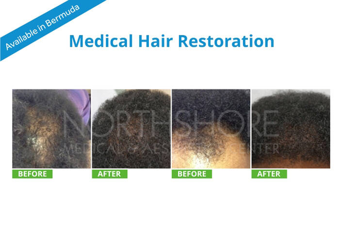 Spamedica Aesthetics Treatments