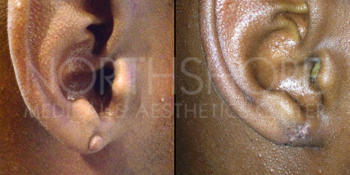 Spamedica Aesthetics Treatments
