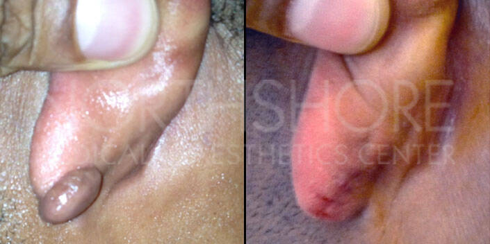 Spamedica Aesthetics Treatments