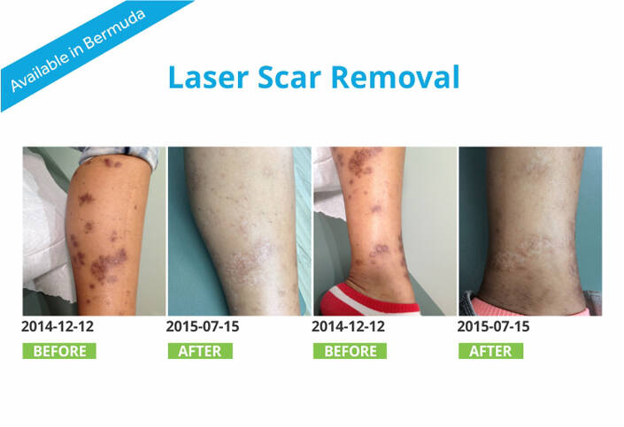 Spamedica Aesthetics Treatments