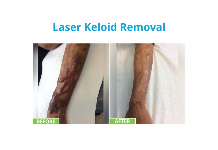 Spamedica Aesthetics Treatments