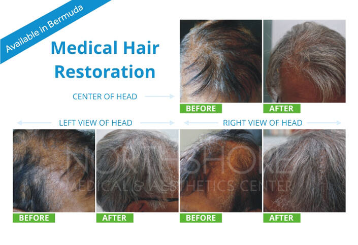 Spamedica Aesthetics Treatments