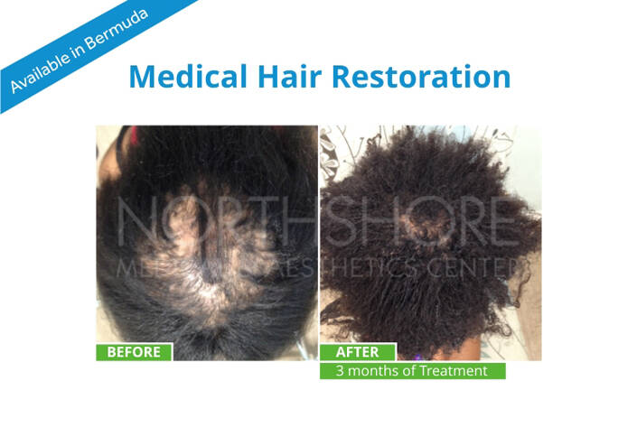 Spamedica Aesthetics Treatments