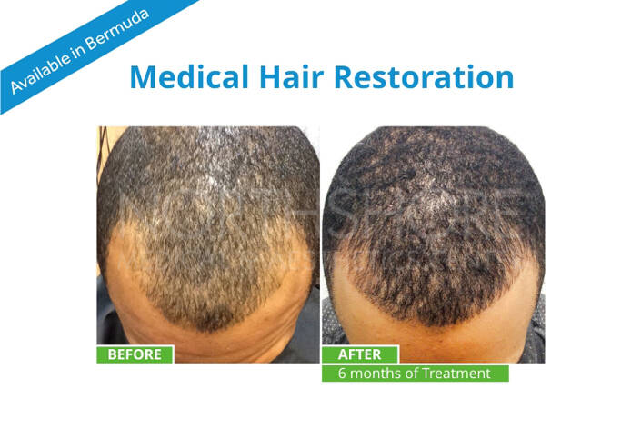 Spamedica Aesthetics Treatments