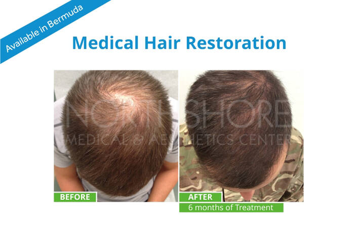 Spamedica Aesthetics Treatments