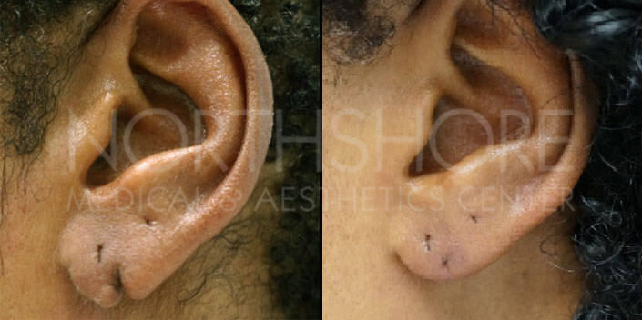 Spamedica Aesthetics Treatments
