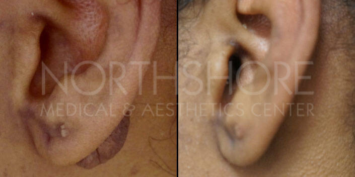 Spamedica Aesthetics Treatments