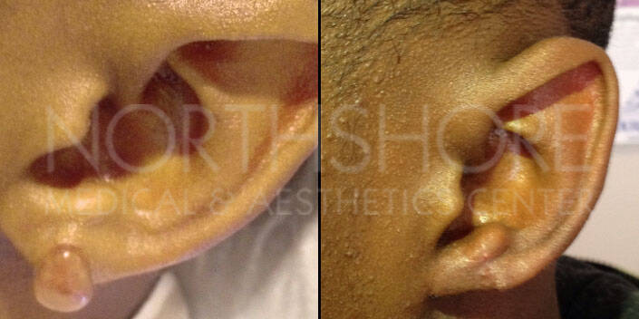 Spamedica Aesthetics Treatments